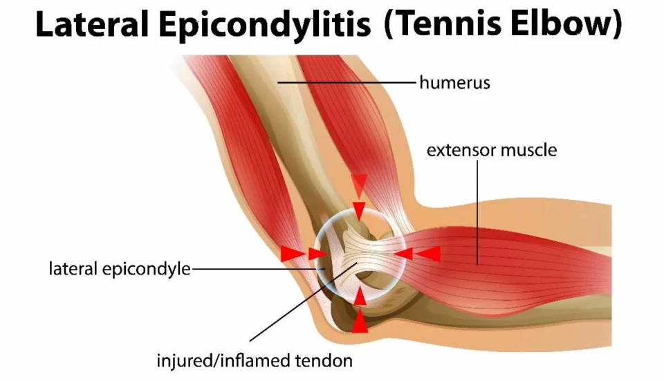 Tennisalbue
